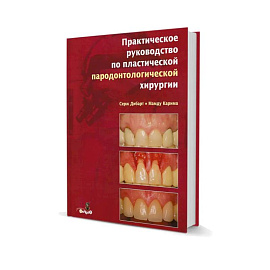 Практическое руководство по пластической парадонтологической хирургии