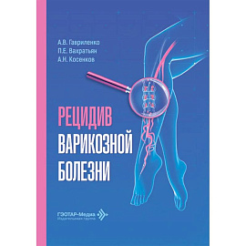 Рецидив варикозной болезни