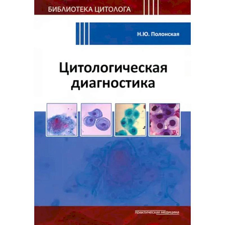 Фото Цитологическая диагностика