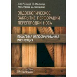 Эндоскопическое закрытие перфораций перегородки носа. Пошаговая иллюстрированная инструкция