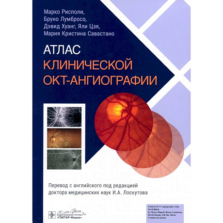 Фото Атлас клинической ОКТ-ангиографии