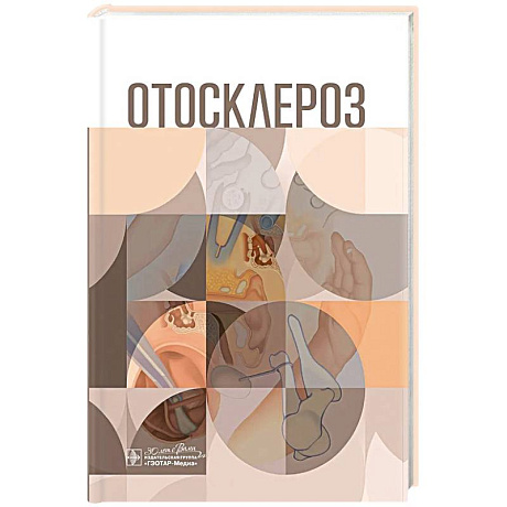 Фото Отосклероз