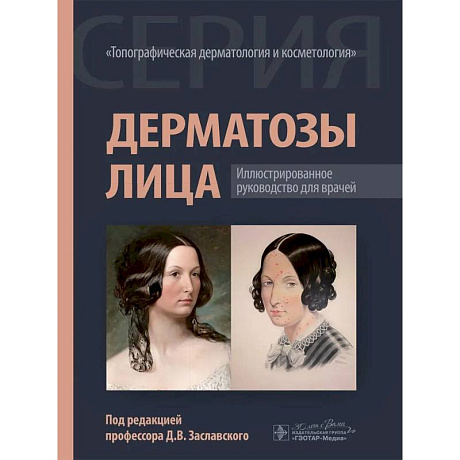 Фото Дерматозы лица: иллюстрированное руководство для врачей
