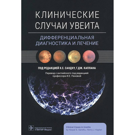 Фото Клинические случаи увеита. Дифференциальная диагностика и лечение