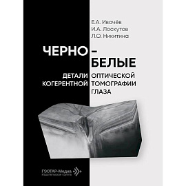 Черно-белые детали оптической когерентной томографии глаза