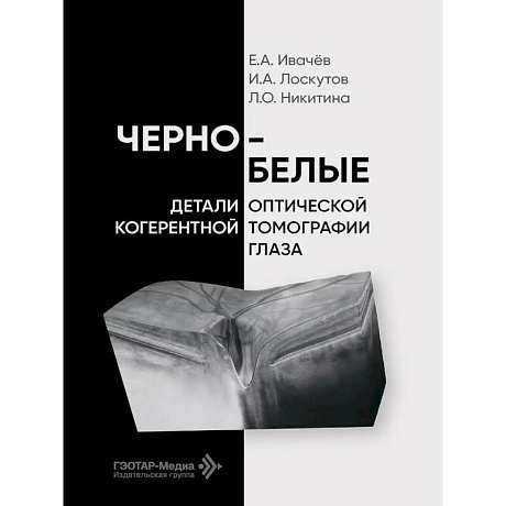 Фото Черно-белые детали оптической когерентной томографии глаза