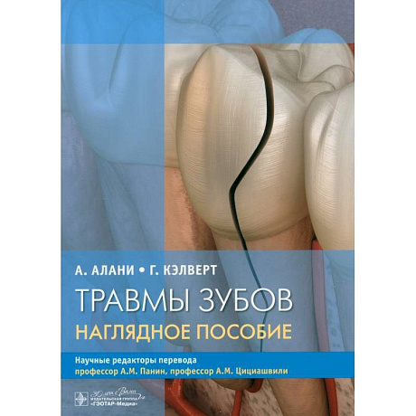 Фото Травмы зубов. Наглядное пособие