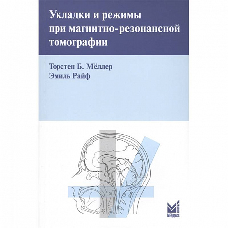 Фото Укладки и режимы при магнитно-резонансной томографии