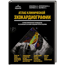 Атлас ЭхоКГ. Иллюстрированное руководство по сложным случаям с видеоинтерпретациями