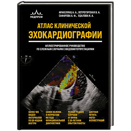 Фото Атлас ЭхоКГ. Иллюстрированное руководство по сложным случаям с видеоинтерпретациями