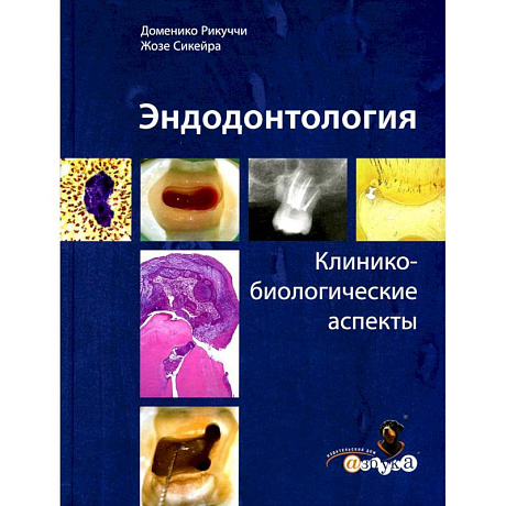 Фото Эндодонтология. Клинико-биологические аспекты