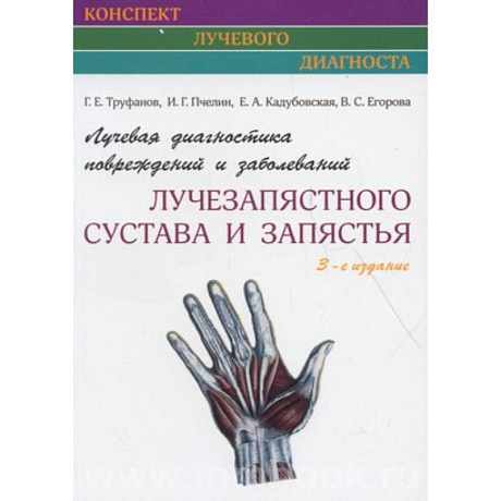 Фото Лучевая диагностика повреждений и заболеваний лучезапястного сустава и запястья