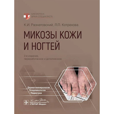 Фото Микозы кожи и ногтей