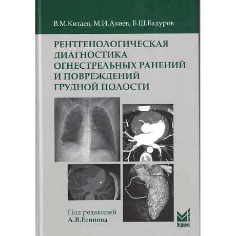Фото Рентгенологическая диагностика огнестрельных ранений и повреждений грудной полости