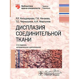 Дисплазия соединительной ткани