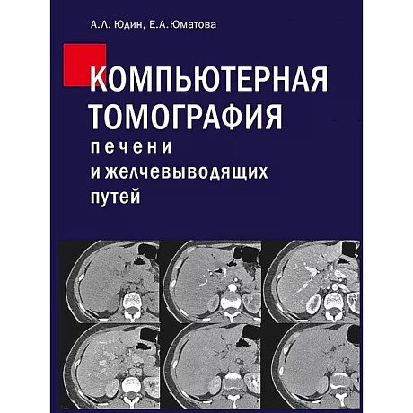 Фото Компьютерная томография печени и желчевыводящих путей: практическое руководство