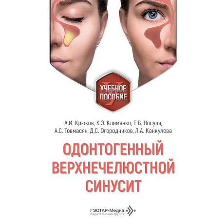 Фото Одонтогенный верхнечелюстной синусит : учебное пособие