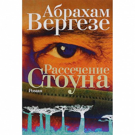 Фото Рассечение Стоуна
