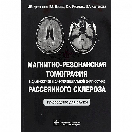 Фото Магнитно-резонансная томография в диагностике и дифференциальной диагностике рассеянного склероза