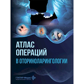 Атлас операций в оториноларингологии