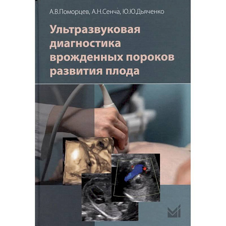 Фото Ультразвуковая диагностика врожденных пороков развития плода
