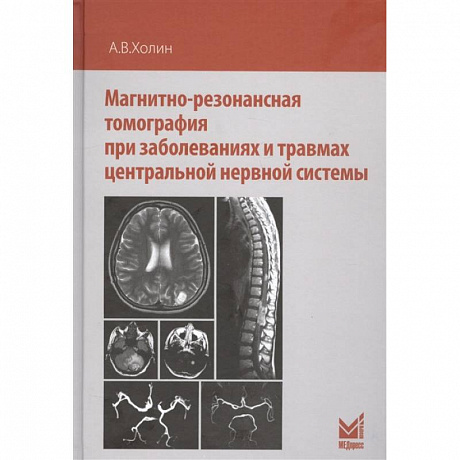 Фото Магнитно-резонансная томография при заболеваниях и травмах центральной нервной системы