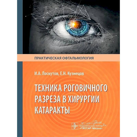 Фото Техника роговичного разреза в хирургии катаракты