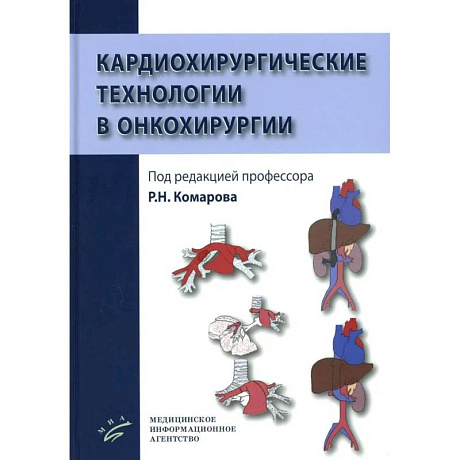 Фото Кардиохирургические технологии в онкохирургии