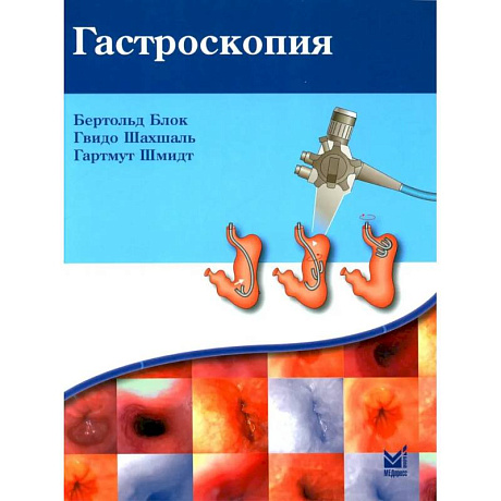 Фото Гастроскопия