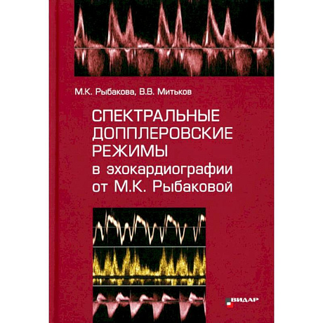 Фото Спектральные допплеровские режимы в эхокардиографии от Рыбаковой М.К