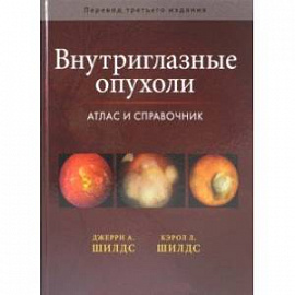 Внутриглазные опухоли. Атлас и справочник