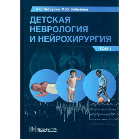 Фото Детская неврология и нейрохирургия. Учебник в 2 томах. Том 1