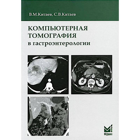 Фото Компьютерная томография в гастроэнтерологии: руководство для врачей.