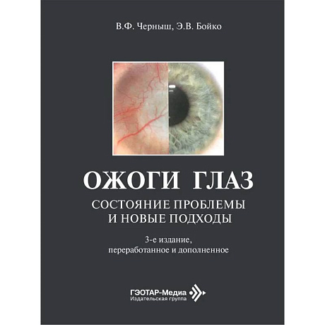 Фото Ожоги глаз. Состояние проблемы и новые подходы