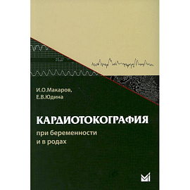 Кардиотокография при беременности и в родах.
