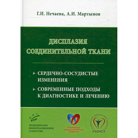 Фото Дисплазия соединительной ткани: сердечно-сосудистые изменения, современные подходы к диагностике и лечению