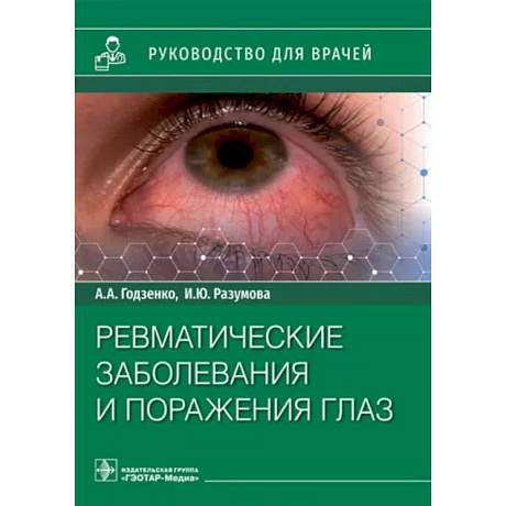 Фото Ревматические заболевания и поражения глаз