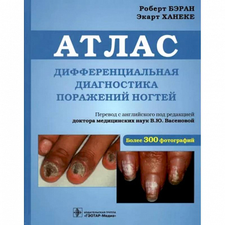 Фото Дифференциальная диагностика поражен ногтей. Атлас