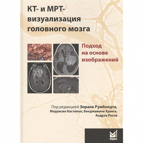 Фото КТ- и МРТ- визуализация головного мозга. Подход на основе изображений