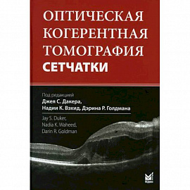 Оптическая когерентная томография сетчатки