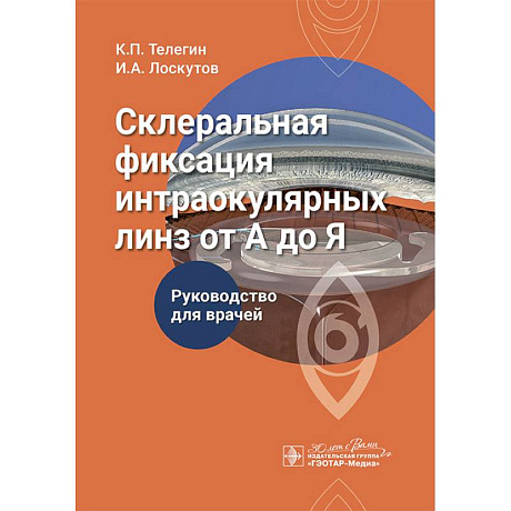 Фото Склеральная фиксация интраокулярных линз от А до Я