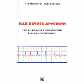 Как лечить аритмии. Нарушение ритма и проводимости в клинической практике