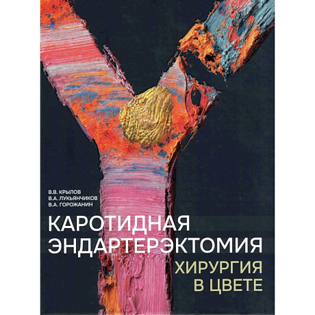 Фото Каротидная эндартерэктомия. Хирургия в цвете