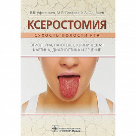 Ксеростомия. Сухость полости рта. Этиология, патогенез, клиническая картина, диагностика и лечение