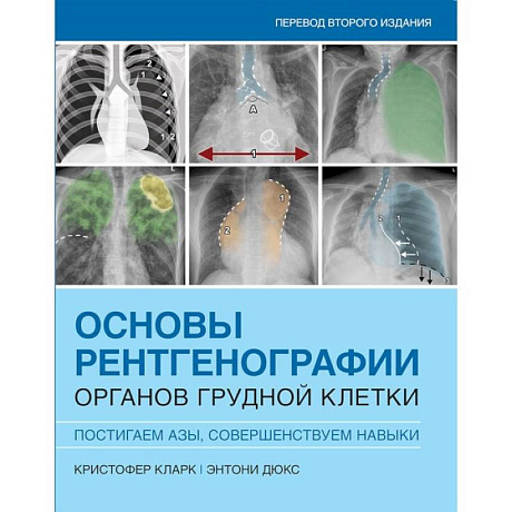 Фото Основы рентгенографии органов грудной клетки