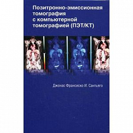 Позитронно-эмиссионная томография с компьютерной томографией