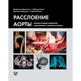 Расслоение аорты. Личные истории пациентов и достижения, спасшие им жизнь