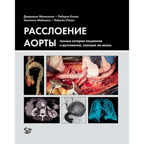 Фото Расслоение аорты. Личные истории пациентов и достижения, спасшие им жизнь