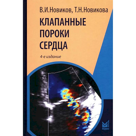 Фото Клапанные пороки сердца