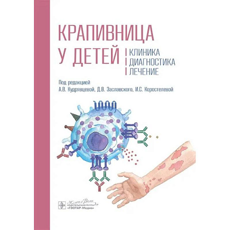 Фото Крапивница у детей. Клиника. Диагностика. Лечение